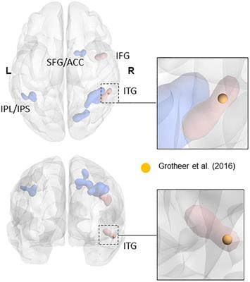 Connectivity of the Human Number Form Area Reveals Development of a Cortical Network for Mathematics